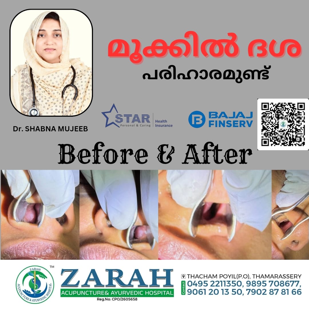 Zarah Acupuncture & Ayurvedic Hospital
