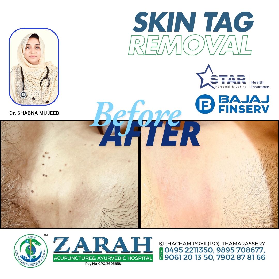 Zarah Acupuncture & Ayurvedic Hospital